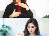 Cách làm giảm hiện tượng trào ngược dạ dày