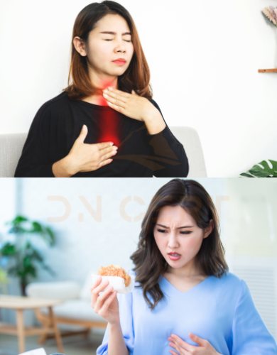 Cách làm giảm hiện tượng trào ngược dạ dày